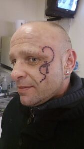face tattoo of a rosary
