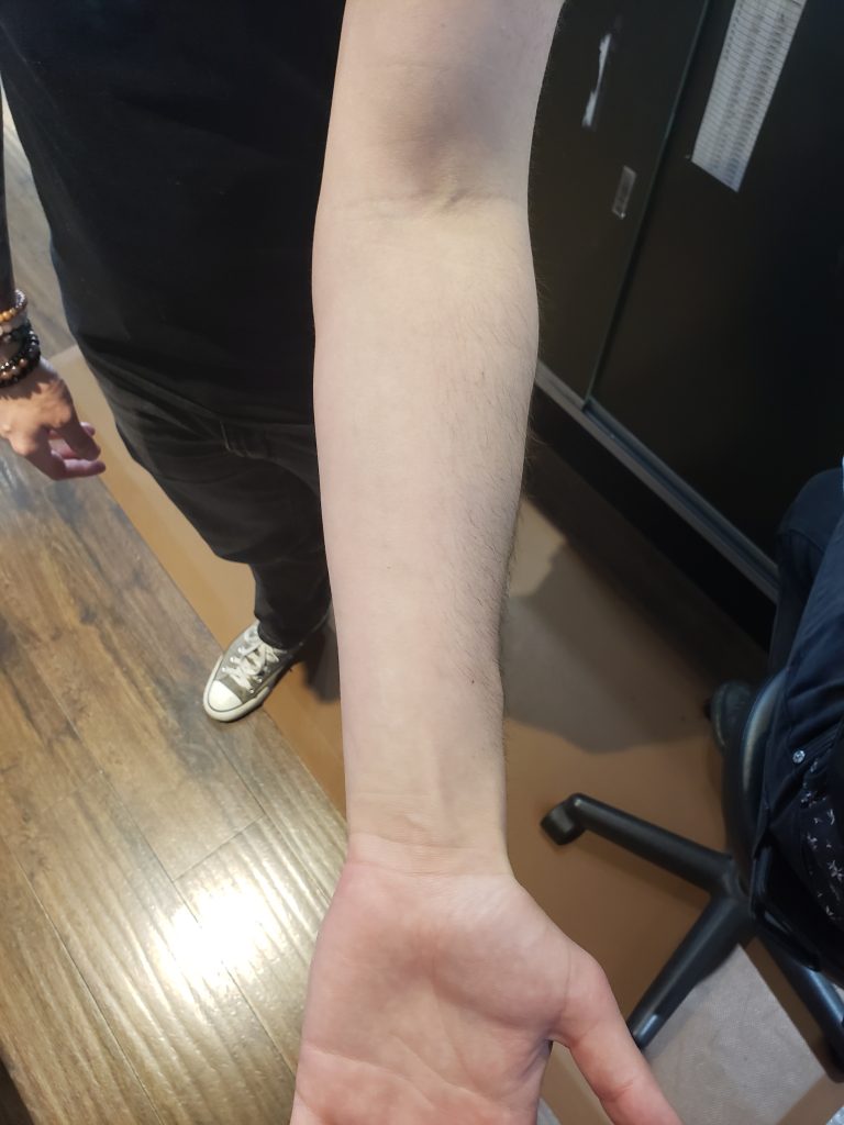 A forearm with no markings.