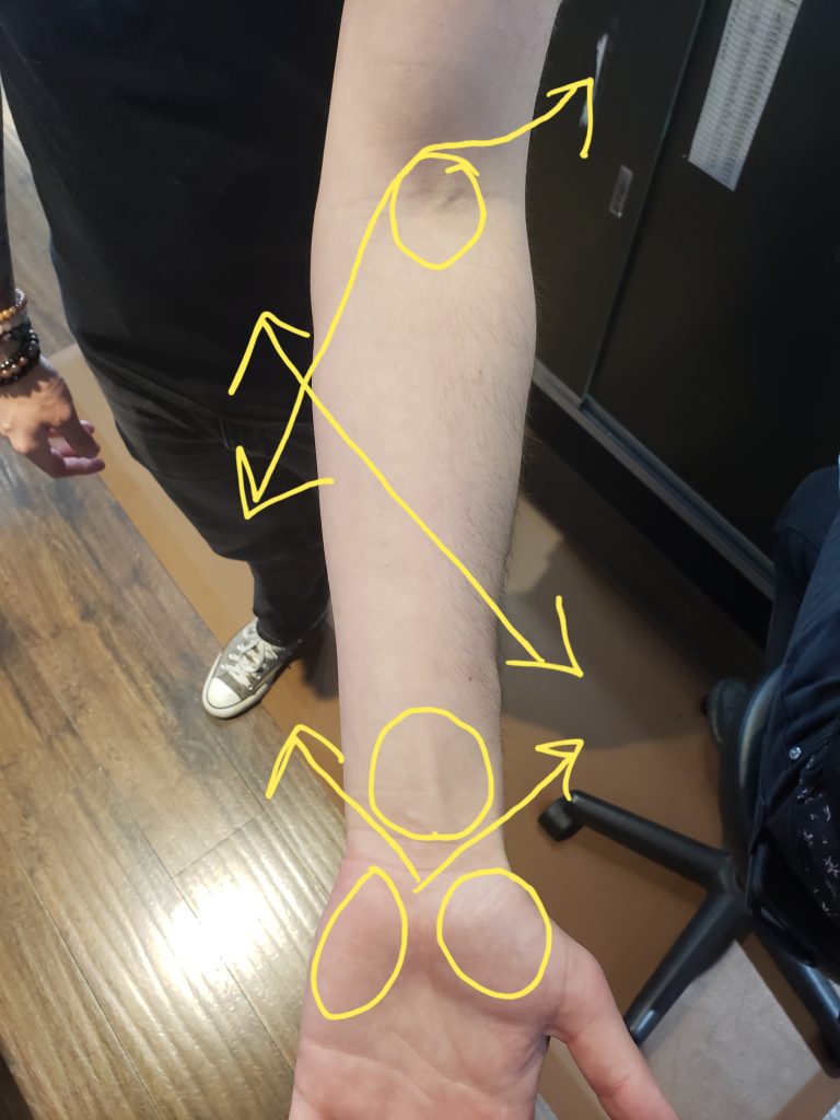 A forearm with basic mapping done.